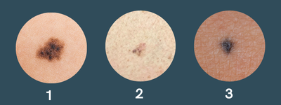 2-4