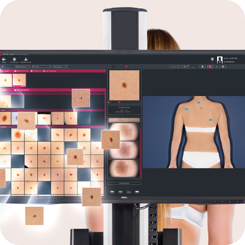 SkinTracker™ | What to Expect