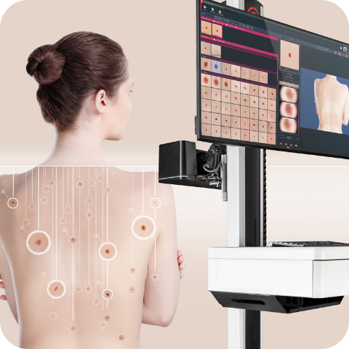 SkinTracker™ | What to Expect