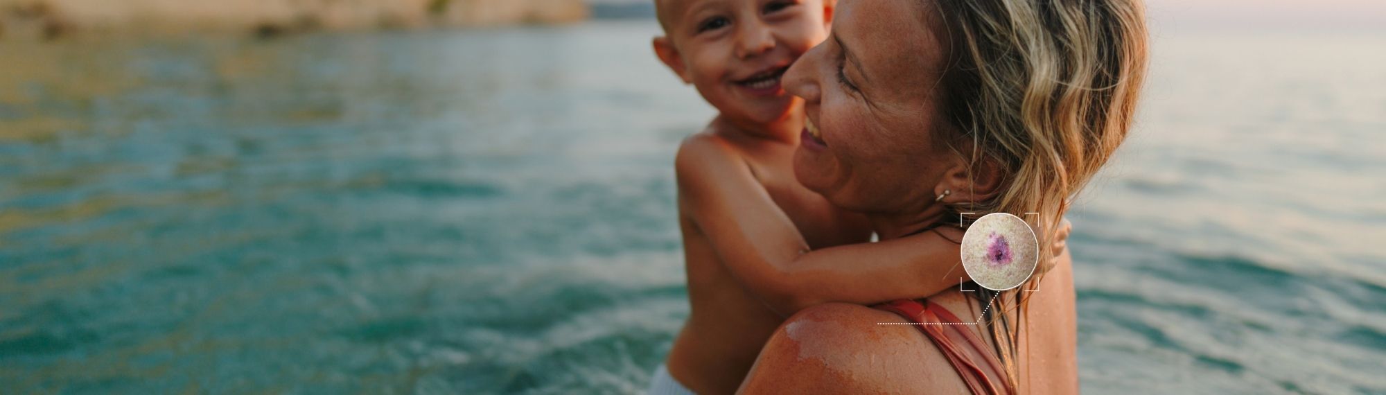 SkinTracker Web Banner